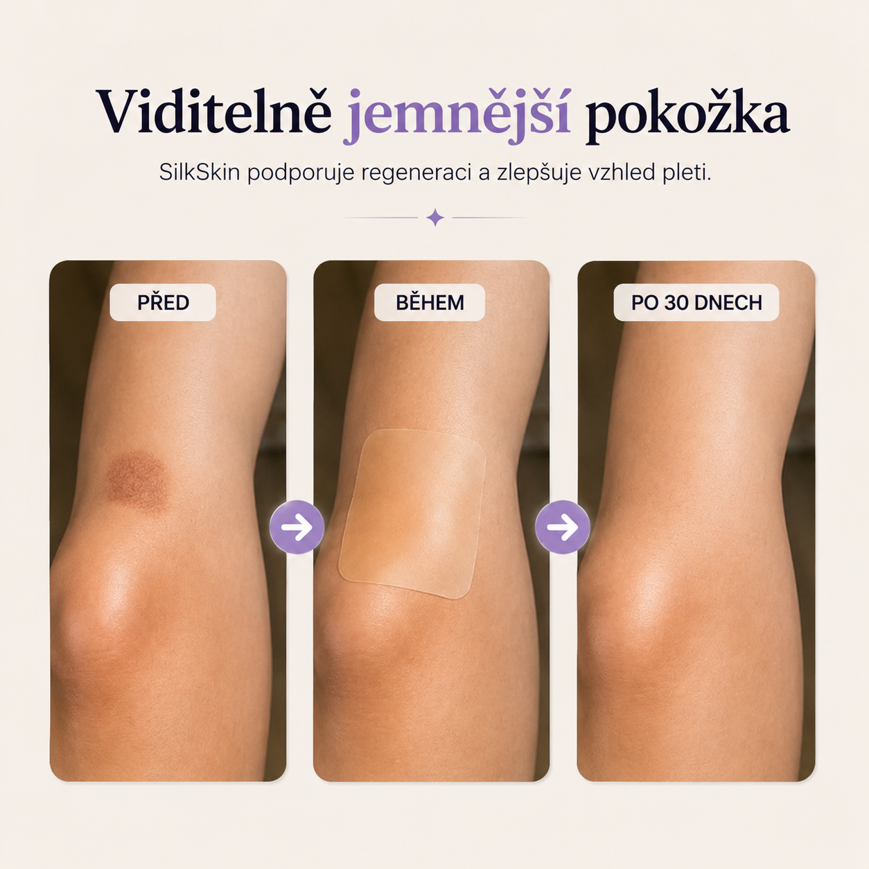SilkSkin: Noční silikonový vyhlazovač vrásek bez jehel a skalpelů