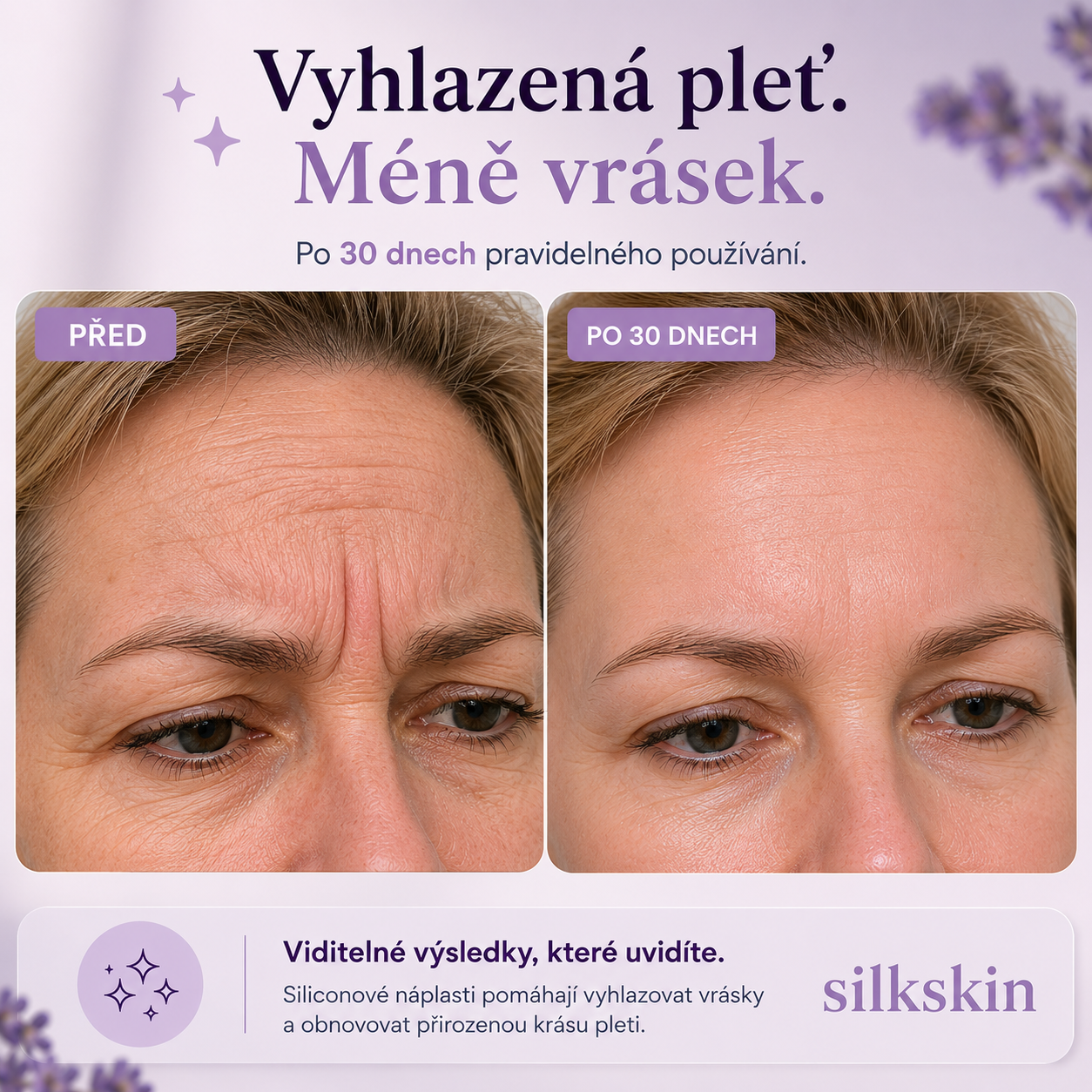 SilkSkin: Noční silikonový vyhlazovač vrásek bez jehel a skalpelů