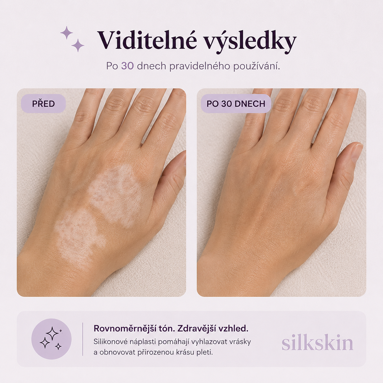 SilkSkin: Noční silikonový vyhlazovač vrásek bez jehel a skalpelů