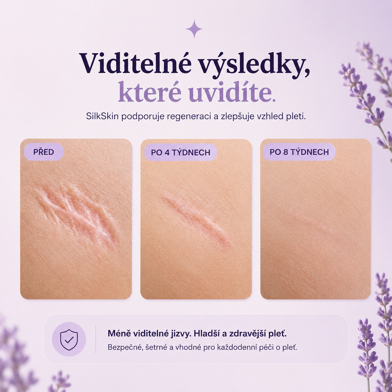SilkSkin: Noční silikonový vyhlazovač vrásek bez jehel a skalpelů