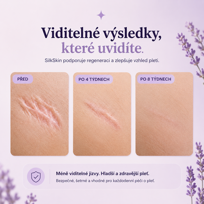 SilkSkin: Noční silikonový vyhlazovač vrásek bez jehel a skalpelů