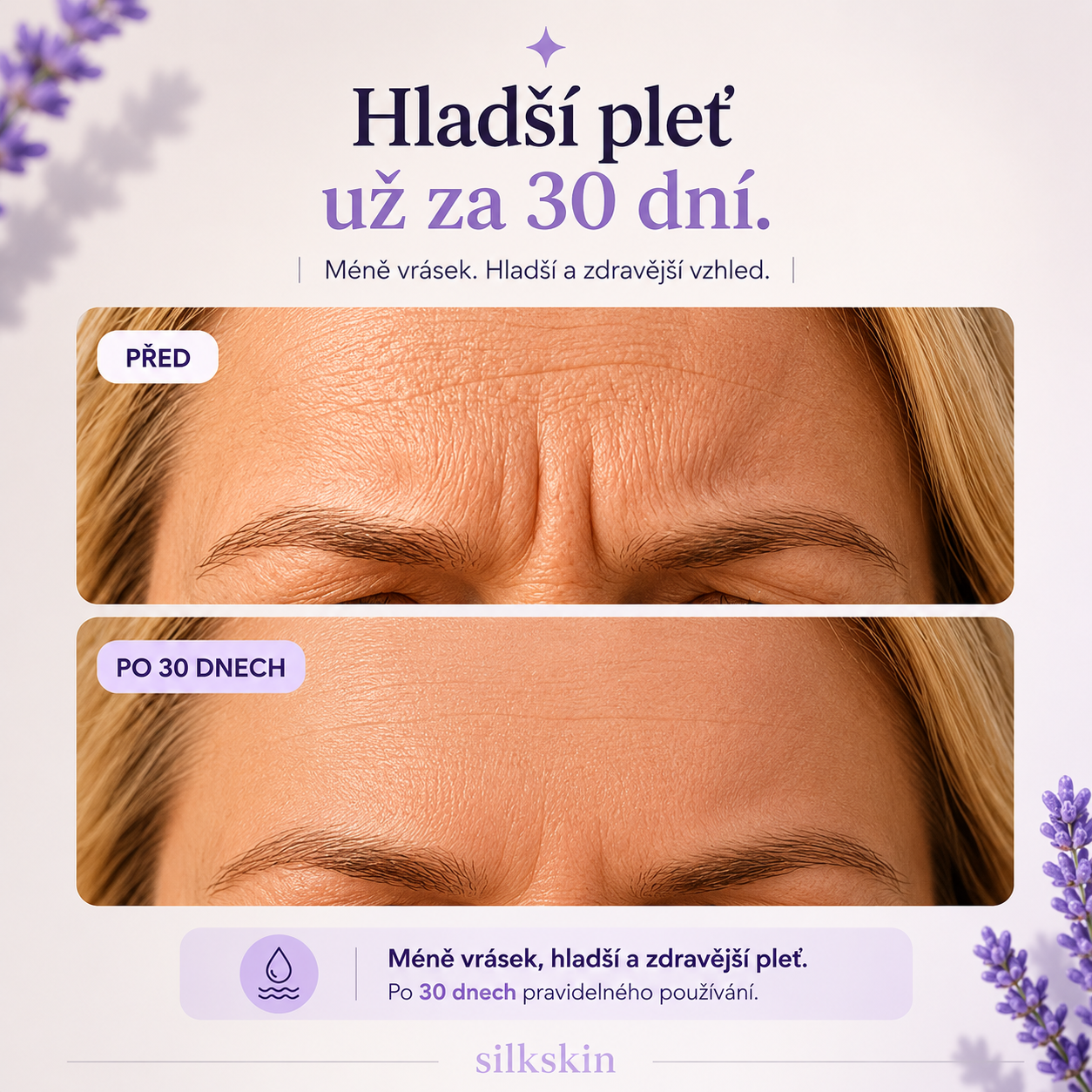 SilkSkin: Noční silikonový vyhlazovač vrásek bez jehel a skalpelů