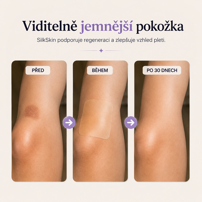 SilkSkin: Noční silikonový vyhlazovač vrásek bez jehel a skalpelů