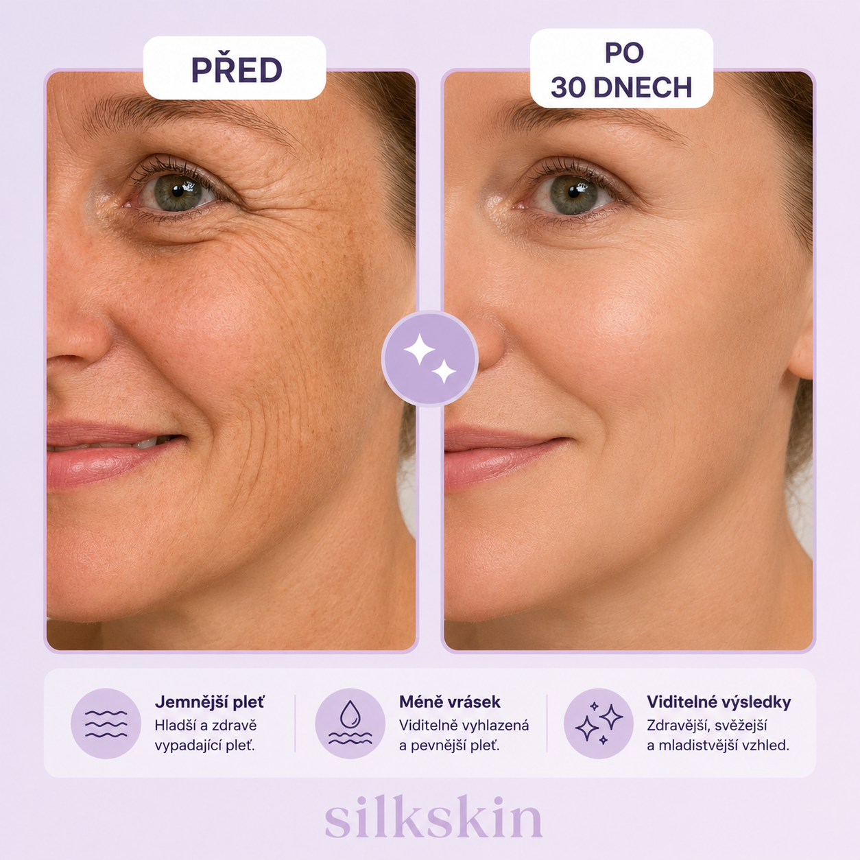 SilkSkin: Noční silikonový vyhlazovač vrásek bez jehel a skalpelů